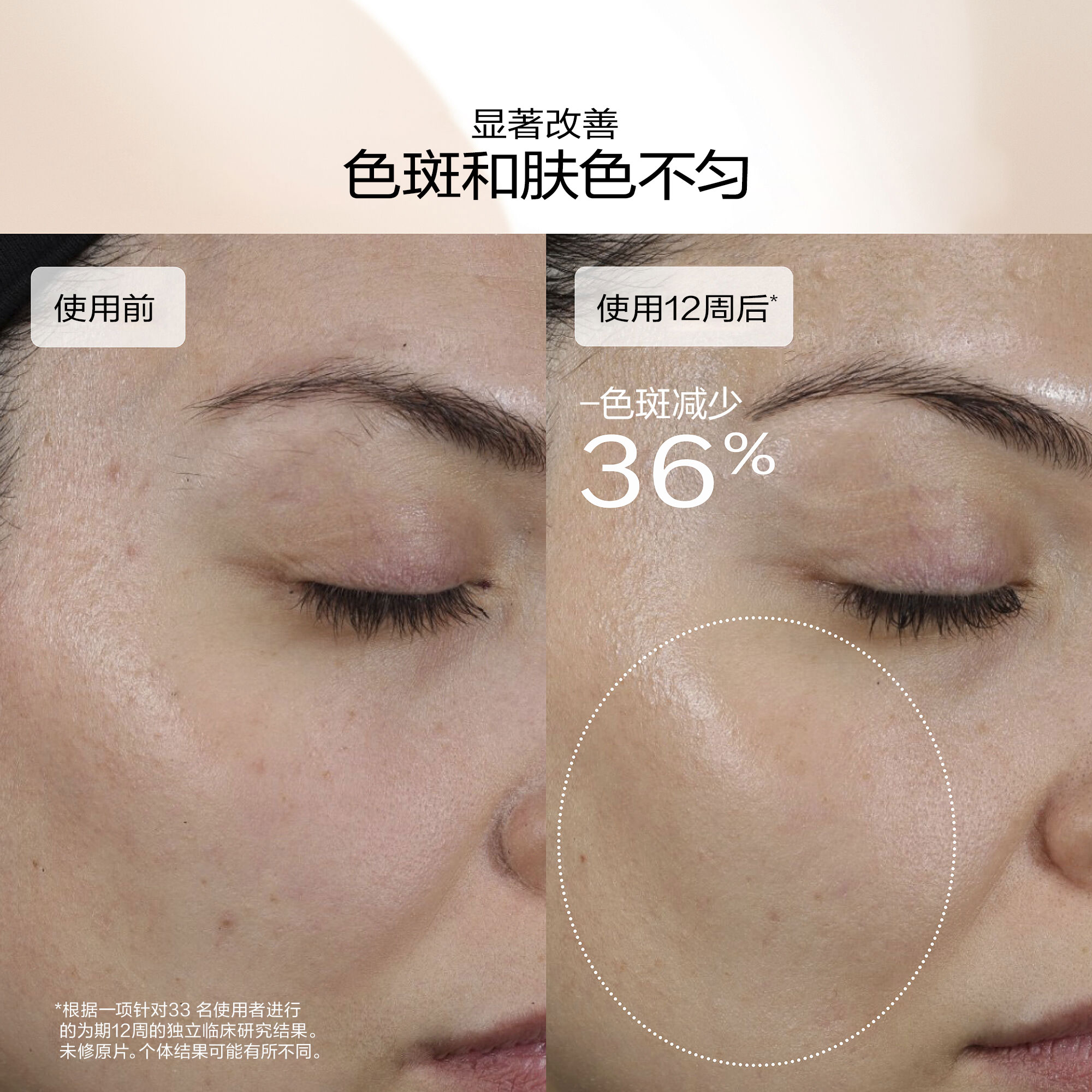 Dark Spot and Wrinkle Smoothing Serum，