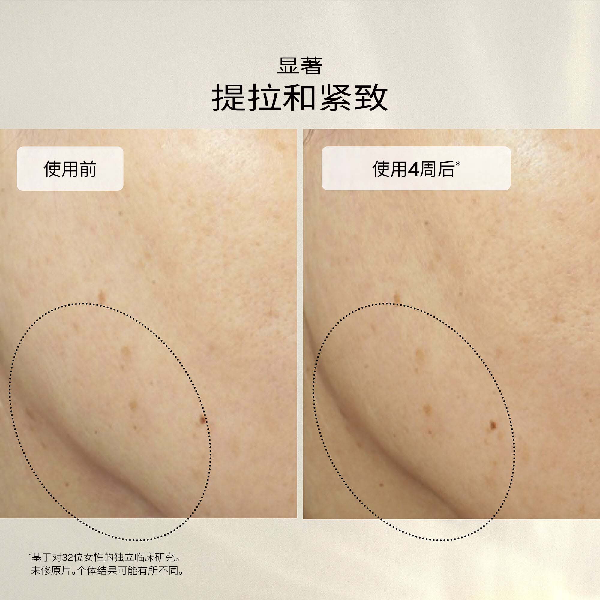 Uplifting and Firming Advanced Cream,