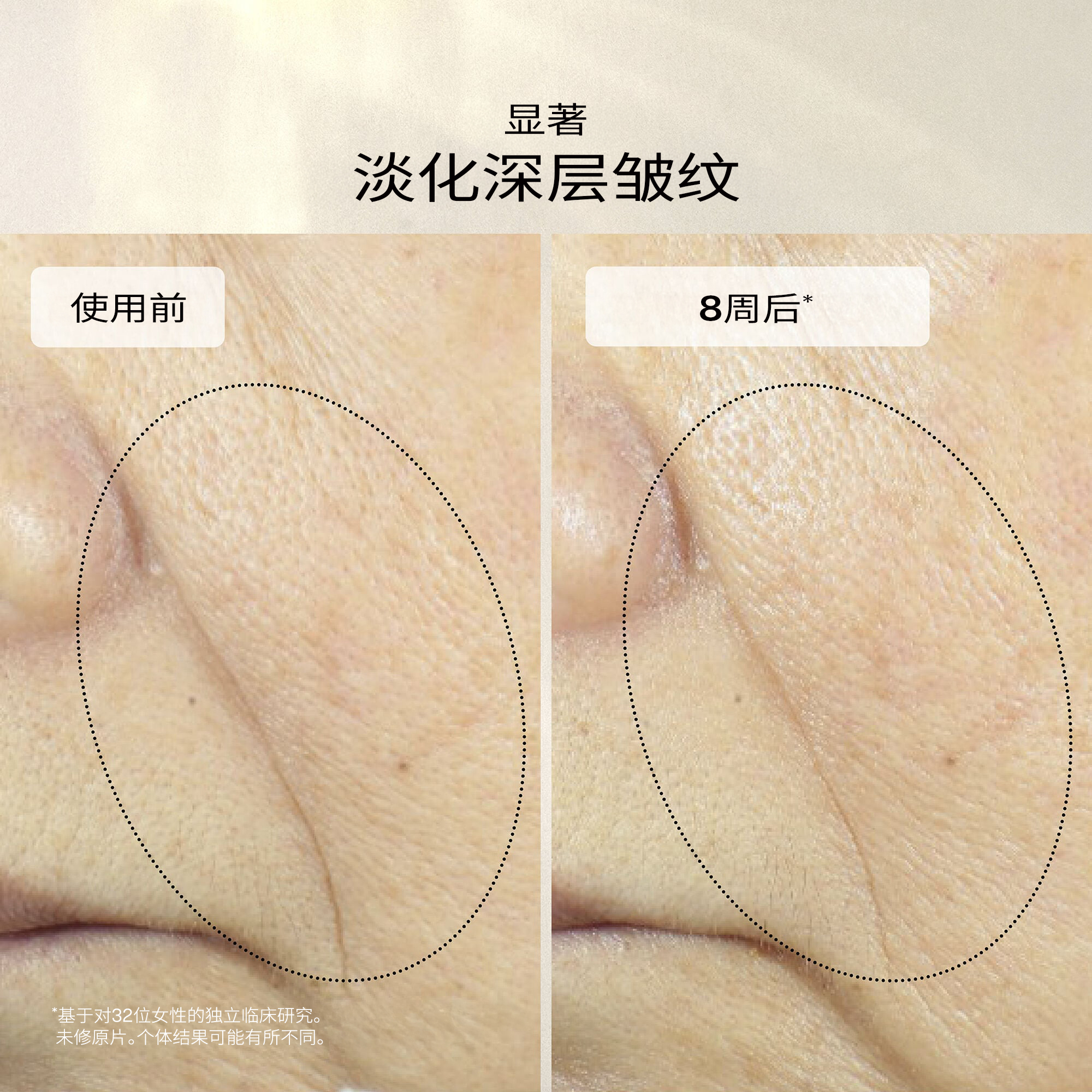 Uplifting and Firming Advanced Cream,