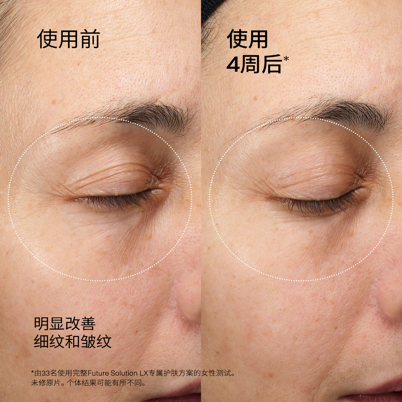 Eye and Lip Contour Regenerating Cream、