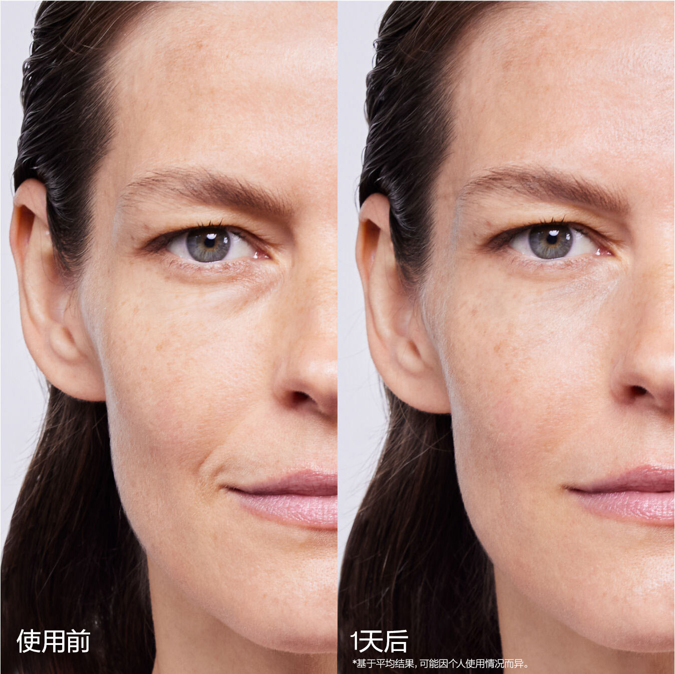 Skin Filler Serums,