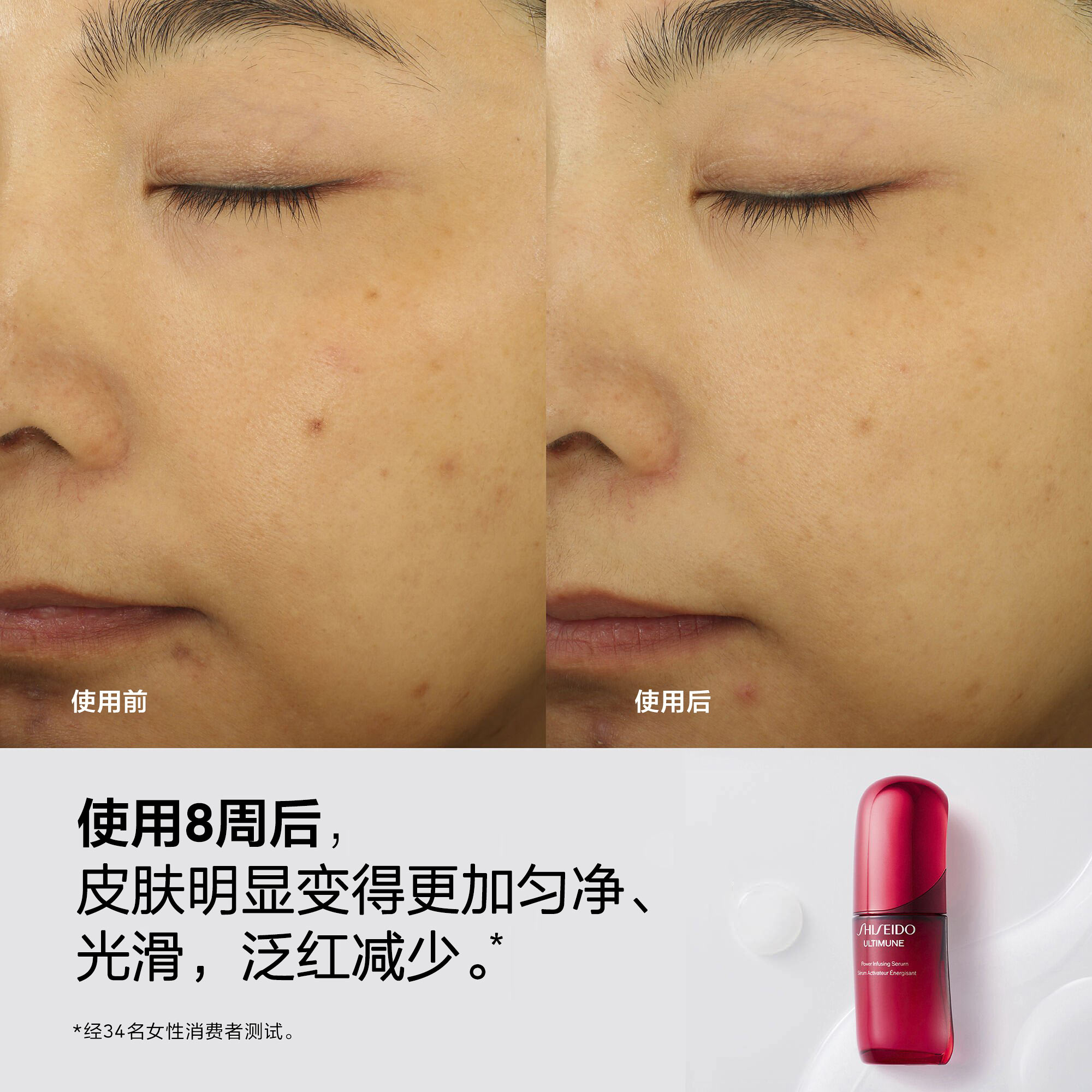 使用8周后的面部对比图，肌肤明显更匀净、细腻，泛红显著改善。同时展示一支红色资生堂UltiMune精华素瓶身。