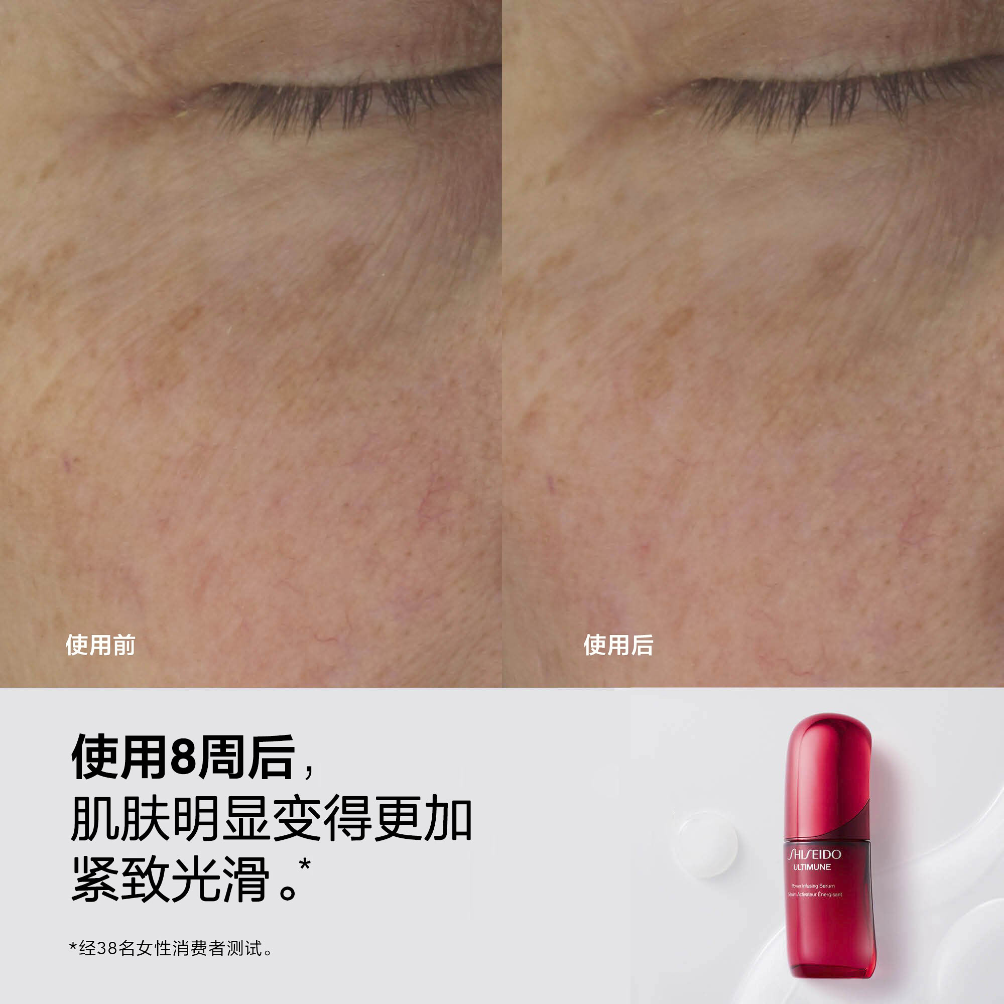 分屏图像，左侧为‘使用前’特写，可见皱纹与晒斑，旁边为‘使用后’特写，肤质明显更平滑，皱纹与色斑明显淡化。下方配有一支红色资生堂ULTIMUNE精华素瓶身，旁附文字：‘使用8周后，肌肤明显变得更加紧致光滑。’