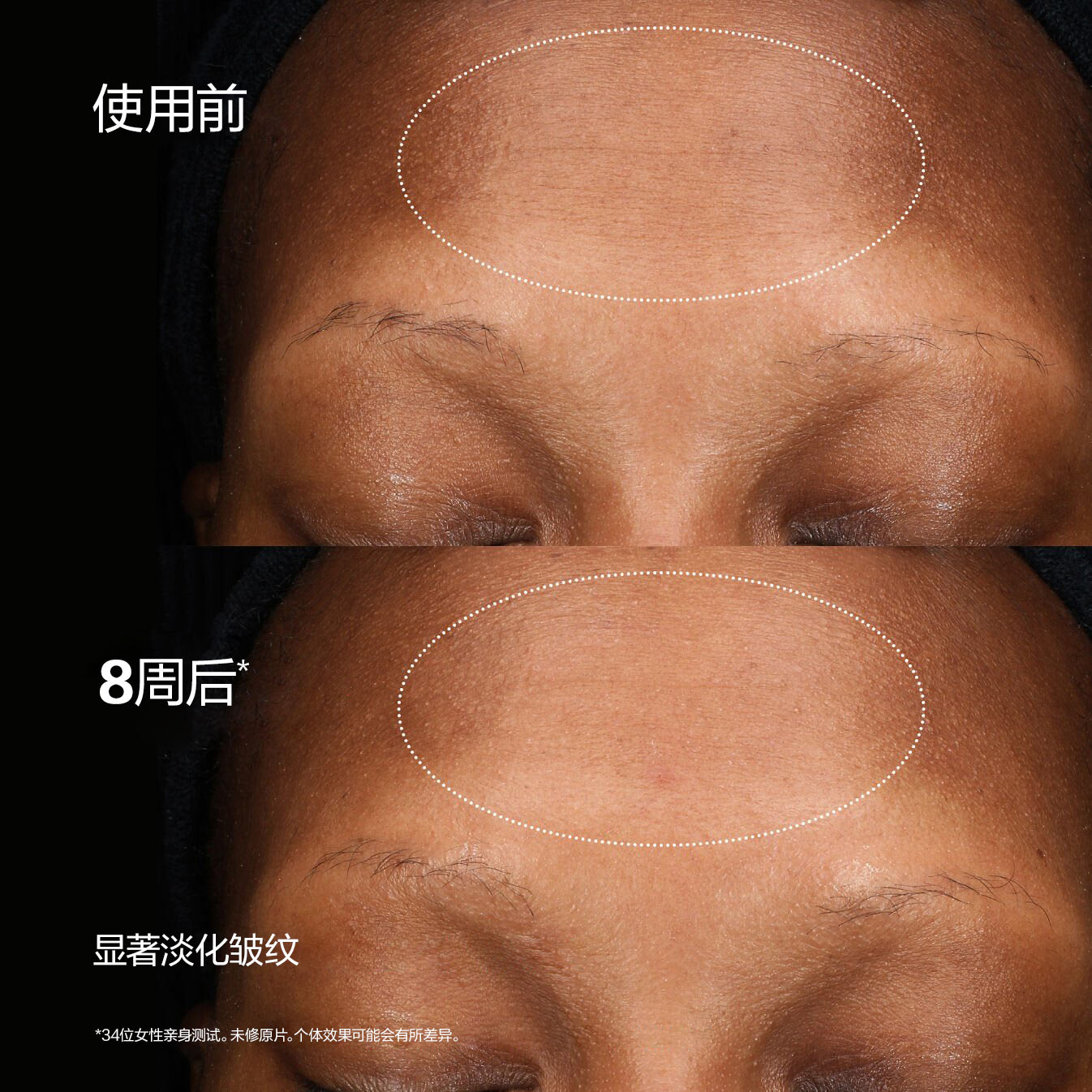 Total Regenerating Cream，