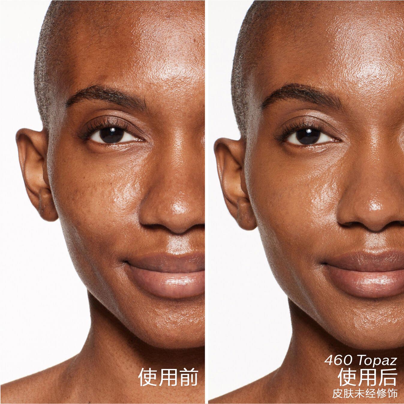 模特的两张对比照片。第一张为使用前照片，第二张为使用460 Topaz后效果。皮肤状态未经修饰。