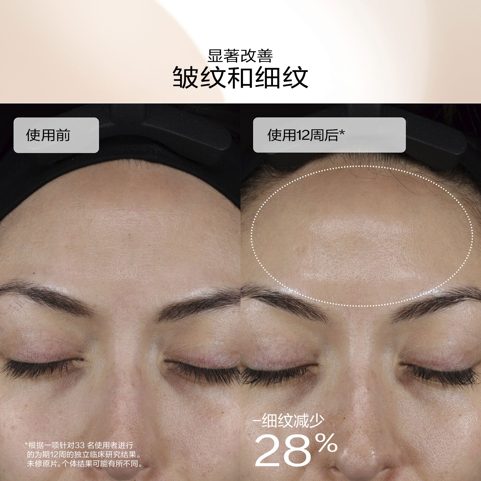 Dark Spot and Wrinkle Smoothing Serum，