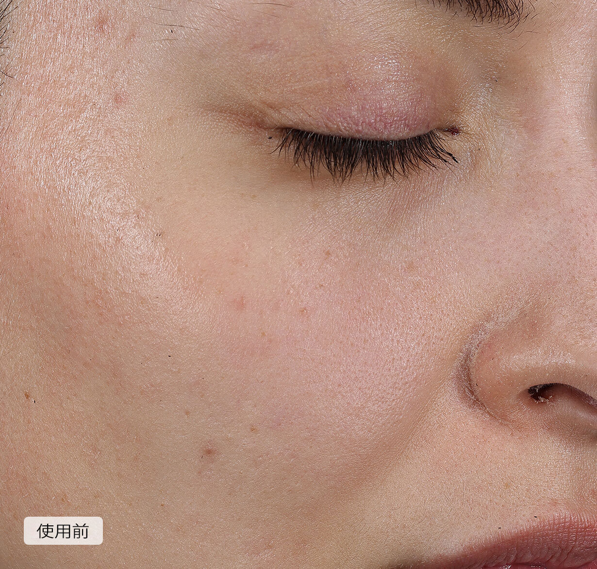Dark Spot and Wrinkle Smoothing Serum，
