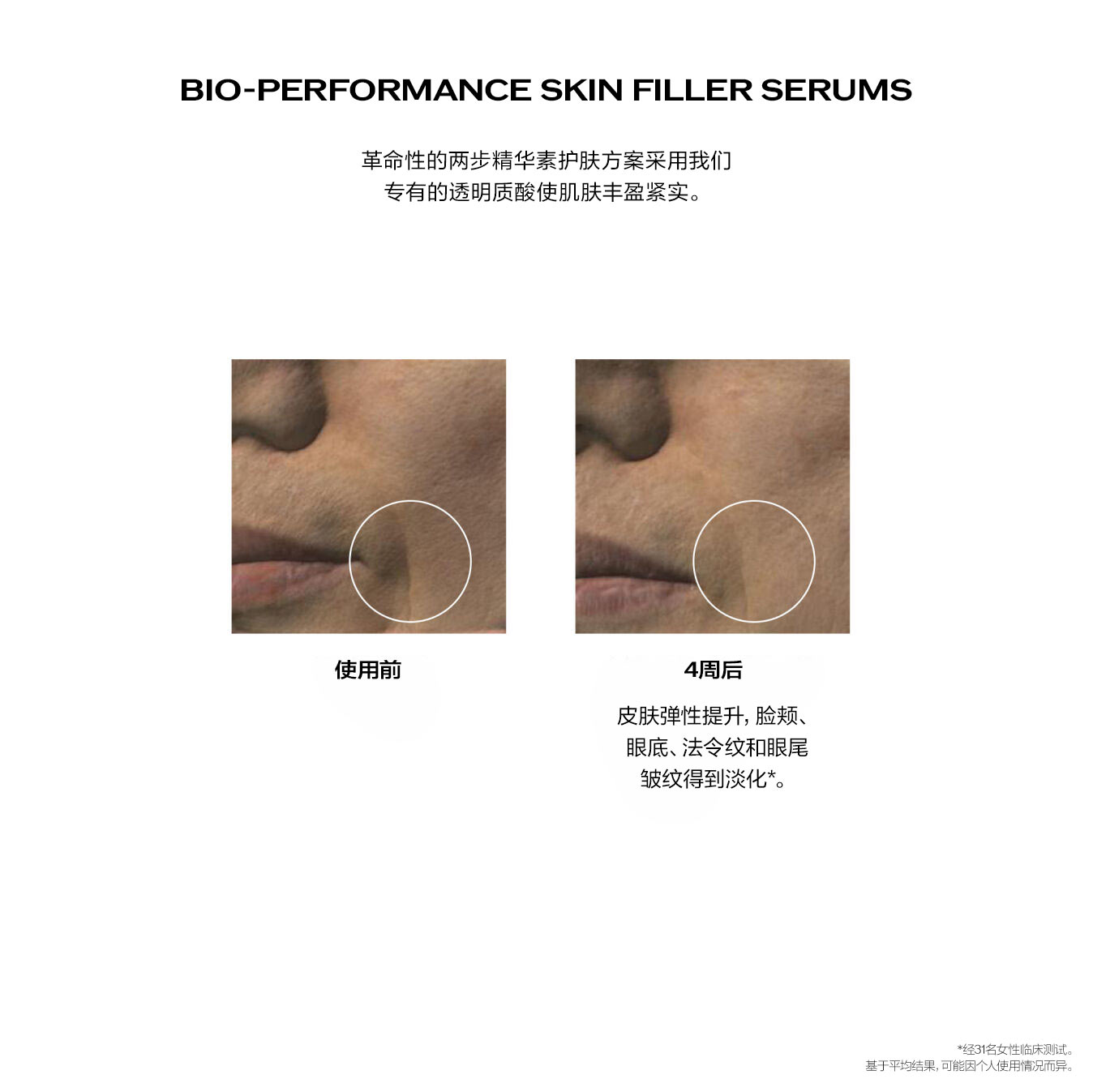 Skin Filler Serums,