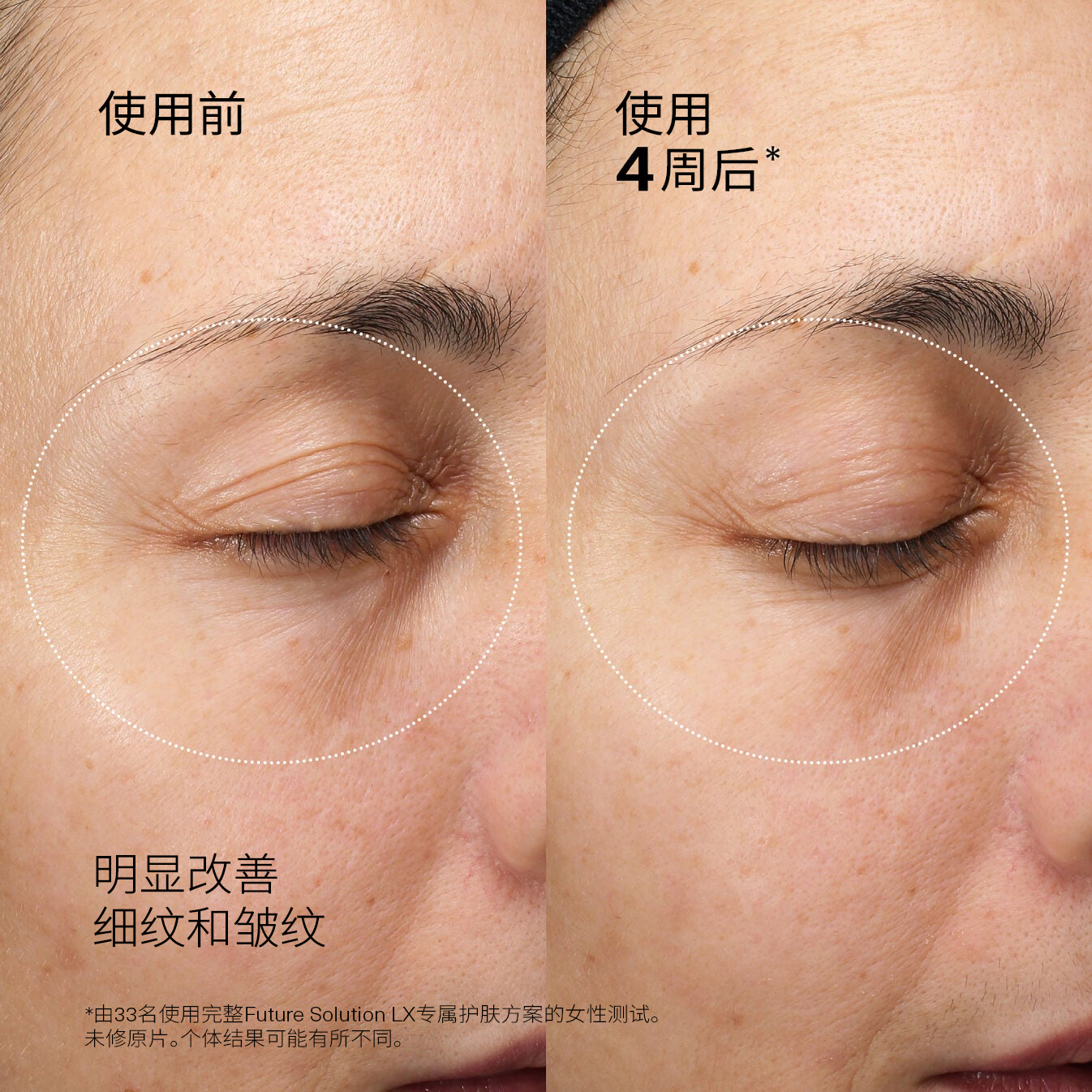 Eye and Lip Contour Regenerating Cream、